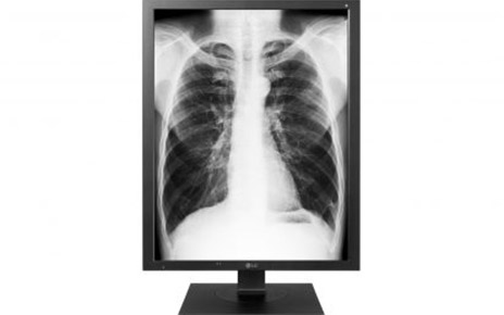LG UNVEILS EXPANDED MEDICAL IMAGING PRODUCT LINEUP AT MEDICA 2017